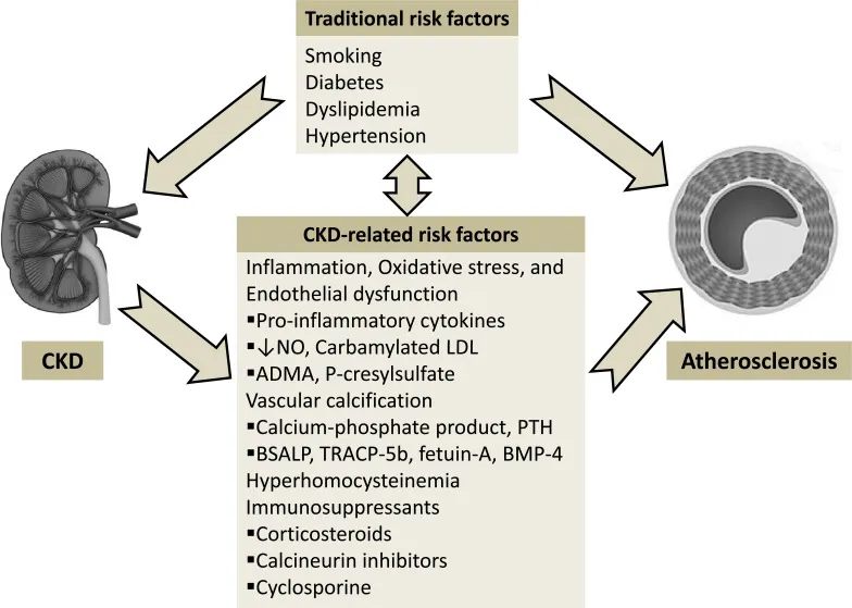 Sơ đồ minh họa cơ chế bệnh sinh phức tạp của quá trình xơ vữa động mạch tiến triển ở người bệnh thận mạn tính (CKD), bao gồm các yếu tố nguy cơ truyền thống và đặc trưng của urê huyết.